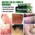 thumbnail image 5 of Herbal Plant Extract Skin Lichen Relief Ointment, Skin Lichen Care for Hands and Feet, Itch Relief - ERAYCEE - 1 Piece, 5 of 5