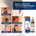 thumbnail image 3 of Gotas para los oídos, Liwei aceite de limpieza coclear 20ml para el alivio del tinnitus para hombres y mujeres Liwei Gotas para los oídos, 3 of 5