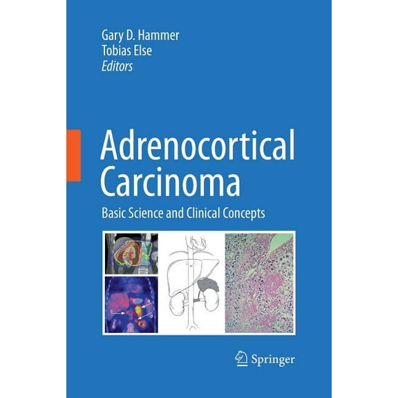 Adrenocortical Carcinoma: Basic Science and Clinical Concepts, (Paperback)