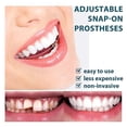 thumbnail image 4 of Adjustable Snap On Prothesens, Adjustable Snap On Denture, Silicone Whitening Denture Braces, Cover The Imperfect Teeth yy, 4 of 4