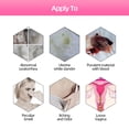 thumbnail image 3 of Desintoxicación vaginal Limpiador de útero Terapia para la vaginitis Crema curativa de la vagina Cuidado de limpieza vaginal Tratamiento ginecológico para mujeres, 3 of 6