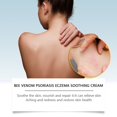 thumbnail image 4 of Seborrheic Dermatitis Paste, Psoriasis Anti-itch Paste, Soothing Moisturizer, For Psoriasis, Folliculitis, Etc, 4 of 9