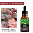 thumbnail image 4 of Nails-Care-Repair Nail-Fungal-Treatment Anti-Fungus Onychomycosis-Removal, 4 of 5