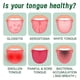 thumbnail image 5 of Tongue Repair Spray for Dryness & Bad Breath, Mouth Odor Eliminator, Fissured Tongue Relief Spray, Instant Dry Mouth Relief, Breath Freshener Spray, 5 of 5