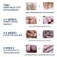 thumbnail image 4 of 3packs Nail Repair Patches, Nail Fungus Treatments, Split Nail Repair, Waterproof And Breathable Foot Care Nail Repair E, 4 of 5