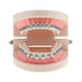 thumbnail image 1 of Modelo de dientes de ortodoncia para estudio odontológico con brackets metálicos, 1 of 3