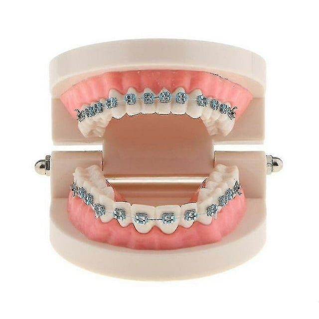Modelo de dientes de ortodoncia para estudio odontológico con brackets metálicos