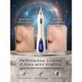 thumbnail image 6 of 6-in-1 Skin Imperfection Removal Pen, 10 Adjustable Levels, Gentle At-Home Personal Care Beauty Tool (Silver), 6 of 8