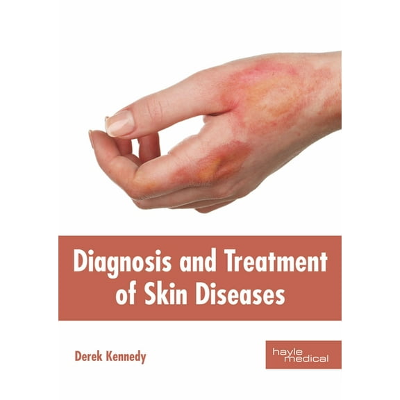 Diagnosis and Treatment of Skin Diseases, (Hardcover)