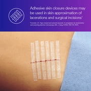 3M Skin & Wound Closure Strips - Reinforced & Sterile Adhesives for Fast Wound & Cuts Healing with Minimal Scarring, Infection Prevention from Suture & Stample Removal - 6mm x 38mm - Pack of 5