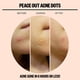 thumbnail image 4 of Parches para acné y espinillas PEACE OUT Skincare Jumbo Box (40 puntos), 4 of 6