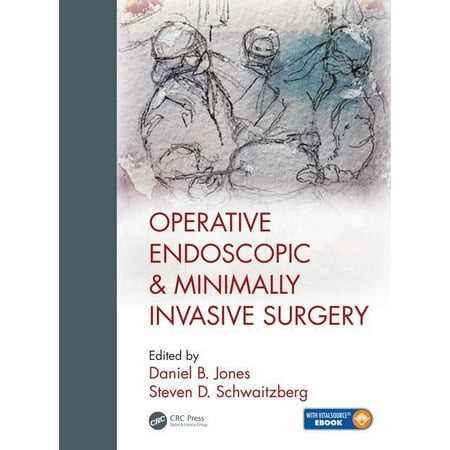 UPC: 9781498708302 | Operative Endoscopic and Minimally Invasive Surgery (Hardcover)