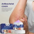 thumbnail image 3 of 1-3pcs Anti-itch cream, Herbal Ointments Itch Repair Cream for Mosquitoes Bite Moisturizing Relieve Redness Itchy Skin Cream, 3 of 5