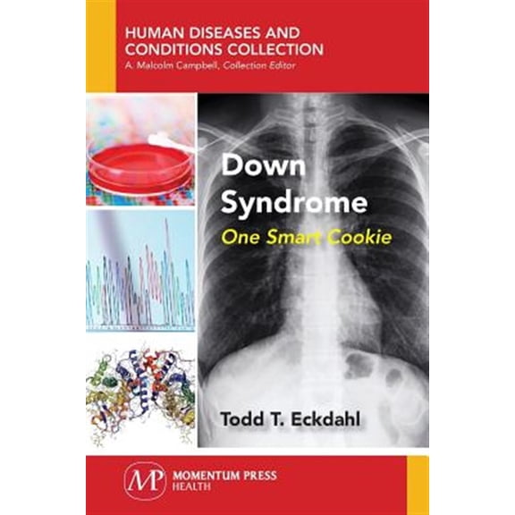 Pre-Owned Down Syndrome: One Smart Cookie (Paperback)