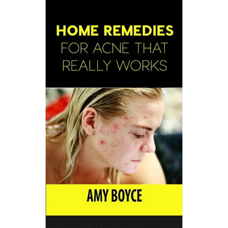 Home Remedies for Acne That Really Works - eBook (The Best Home Remedy For Acne)