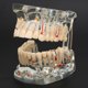 thumbnail image 4 of Modelo de dientes de enfermedad transparente, modelo de dientes de implante Dental, instrumentos de enseñanza para estudio hospitalario, 4 of 8