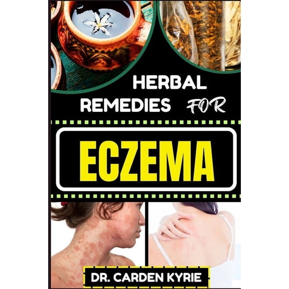 Herbal Remedies for Eczema: Unlocking Nature's Healing Power With Herbs For Flourishing Skin, Holistic Wellness, Lasting, (Paperback)
