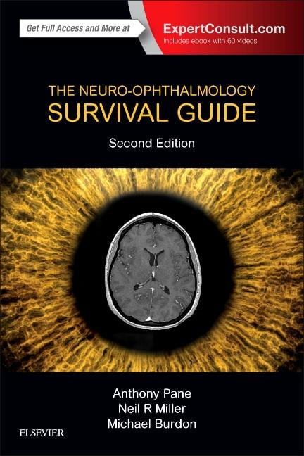 The Neuro-Ophthalmology Survival Guide (Edition 2) (Paperback ...