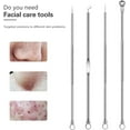 thumbnail image 4 of Blackhead Removal Tool, Pimple Popper Extractor Tool Kit, Used for Removing Blackheads, Acne, Comedone, Flaw White Heads on Nose and Face, Professional Stainless Steel Removal Tool., 4 of 5