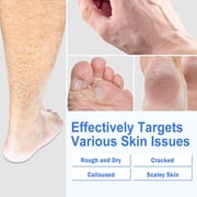 Mooyam Urea Cream 40% plus Salicylic Acid 2%, Foot & Hand Cream for Rough Dry Cracked Skin, Urea Lotion for Feet 5.29 oz