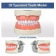 thumbnail image 2 of Dentadura Médica Con 32 Dientes, Modelo Dental Extraíble, 2 of 6