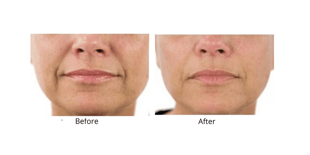 Dr. Sevinor’s NEW Genuine Facelift Solution Concentrated Serum Jumpstarts Tired Looking Skin, Diminishes Wrinkles/Lines Renews Skins Elasticity