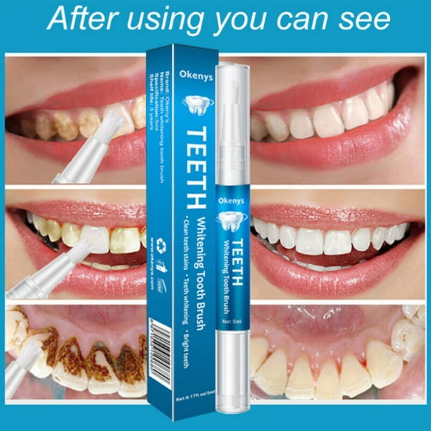 Gorgelen wijsvinger Wiens Teeth Whitening Pen Remove Yellow Teeth Cigarette Dental Plaque Brighten  Teeth Cleaning Oral Hygiene - Walmart.com