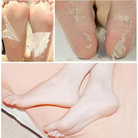Hot Remove Dead Skin Foot Mask Peeling Cuticles Heel Feet Care Anti