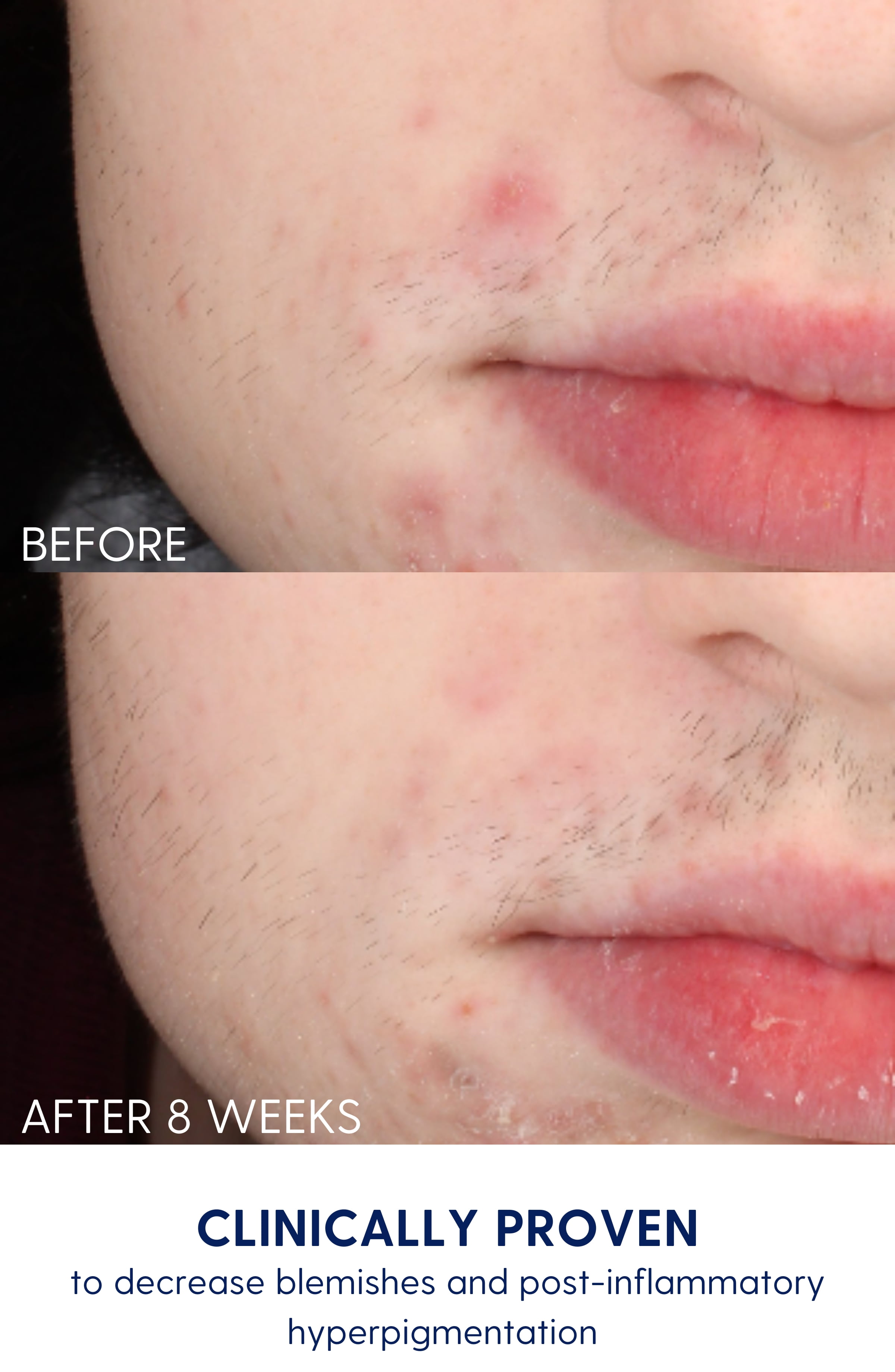 Bright Girl Bright + Clean Gel Face Wash for Teen Skin, 6.7 oz