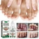 thumbnail image 1 of EELHOE Nail Repair Serum Anti Fungal Nail Treatment Remove Onyc, 1 of 4