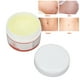 thumbnail image 5 of Crema reparadora de estrías ANGGREK Multibeneficios para el hogar, 5 of 8