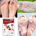 thumbnail image 4 of Mascarilla exfoliante para pies, paquete de 1, descamación de callosidades y células muertas de la piel, suave para bebés, mascarilla exfoliante Sunnimix Calcetines para pelar los pies, 4 of 8