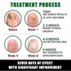 thumbnail image 5 of 30 ml Cuidado de uñas Reparación Antifúngico de uñas Eliminación de onicomicosis Líquido de jengibre Tratamiento antifúngico para uñas Aceite de jengibre para el cuidado de cutículas, 5 of 5
