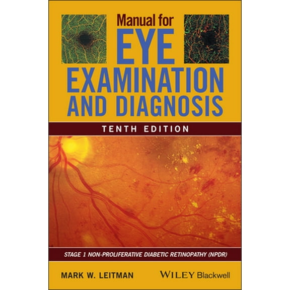 Pre-Owned Manual for Eye Examination and Diagnosis (Paperback) 111962858X 9781119628583