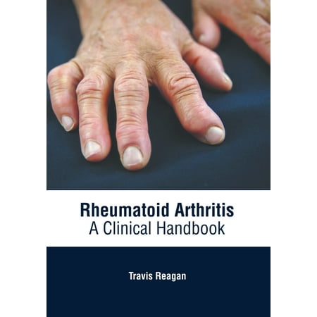 UPC: 9781639274758 | Rheumatoid Arthritis: A Clinical Handbook (Hardcover)