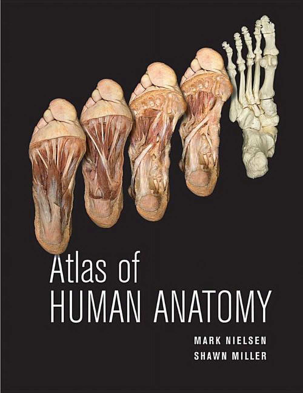 Atlas of Neurosurgical Anatomy: The Pterional Perspective