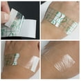 thumbnail image 2 of Ruban de Fixation Médicale Adhésif Transparent Imperméable 10 cm x 10 m, Protection de la Peau Extensible, Canule, Ruban pour Plâtre et Soins des Plaies, 1 Rouleau, 2 of 6
