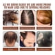 thumbnail image 5 of 1-5Pcs 100% Pure Honduran Batana Oil Natural Butter for Hair Growth, Alopecia Areata & Hair Loss Treatment, 5 of 5