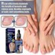 thumbnail image 2 of Professional Foot Anti-fungal Treatment Solution To Remove Onychomycosis Care Repair Liquid Healthy Nail Care Repair Liquid, 2 of 4