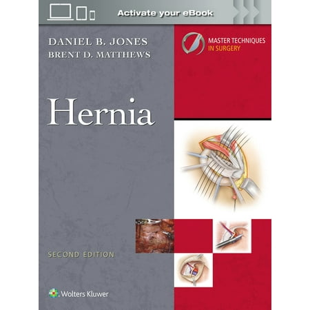 Master Techniques in Surgery Master Techniques in Surgery: Hernia: Print + eBook with Multimedia (Hardcover)
