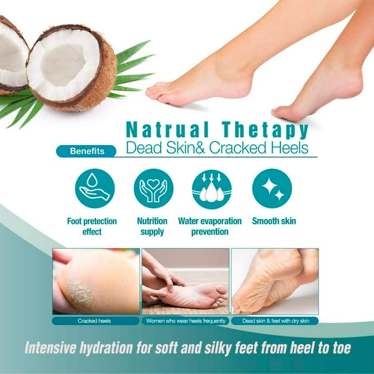 Coconut oil for dry heels best sale