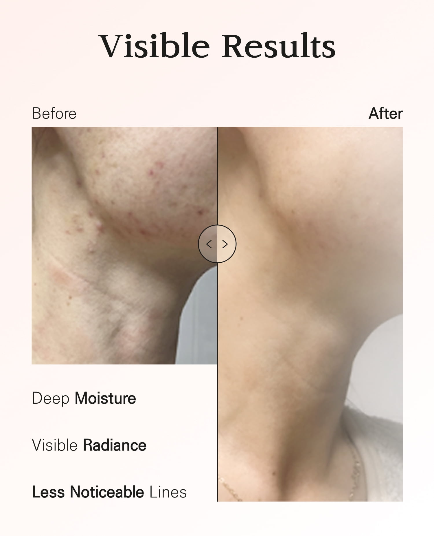 BLANC DUBU Nuborn Cell Hydrogel Collagen Neck Mask with hADSC-CM Stem Cell Marine Collagen 9-Peptide Firming Brightening Neck Wrinkle Patch All Skin Types 5 x 0.49 oz
