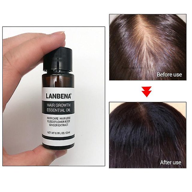 20ml Hair Growth Essential Oil Hair Care Hair Loss Fleeceflower Root Ginger Extract Lanbena Makeup