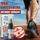 thumbnail image 2 of South Moon Vein Massage Varicose Vena Spray Suaviza las protuberancias de las venas Suaviza las piernas de lombriz de tierra Masaje de piernas Aceite de masaje 1 pieza) -GSL | |, 2 of 5