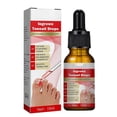 thumbnail image 2 of Ingrowth Toenail Correction Oil Ingrown Toenail Drops Nail Care for Ingrown Toenails, 2 of 5
