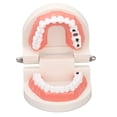 thumbnail image 5 of Modelo De Caries Dental, Enfermedad Dental Caries Modelo De Dientes Resina Simulación Enseñanza Prop Modelo De Dientes Dentales Para La Educación Del Estudiante Del Paciente, 5 of 5