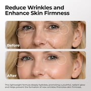 Skin Deva Argireline Peptide Serum with Hyaluronic Acid for Hydration & Smoother-Looking Skin, Lightweight Facial Serum, 1 fl oz