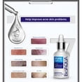 thumbnail image 3 of Crema hidratante para el acné HUOGUO para rostro 30 g, 3 of 5