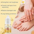 thumbnail image 2 of Bee Venom Fungal Nail Treatment for Toenail Extra Strong, Nail Fungus Solution, Anti Toe Toenail Nail Fungal Solution for Ingrown Toenail Treatment, 2 of 4