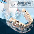 thumbnail image 2 of New Dental Teaching Study Standard Tooth Model Demonstration Disease Educational, 2 of 4